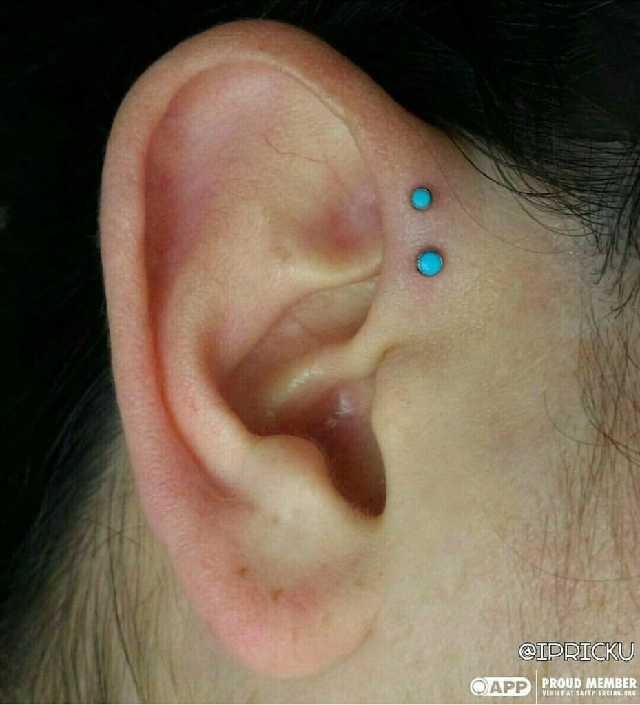 Forward Helix Piercing in Staten Island, NYC | Professional Piercing Double forward helix piercing featuring titanium threadless ends with bezel-set turquoise gemstones from NeoMetal, showcasing precise