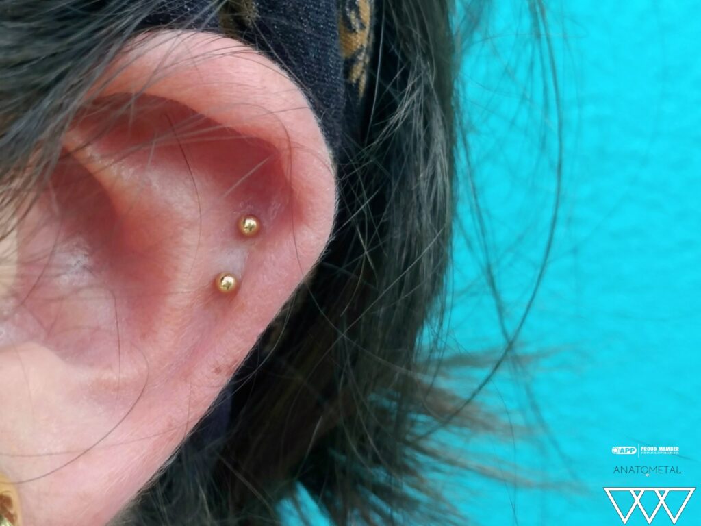 A freshly executed double helix piercing, each adorned with 18k rose gold threadless bead ends from Anatometal, showcasing precise alignment and a warm, elegant glow on the upper ear cartilage.