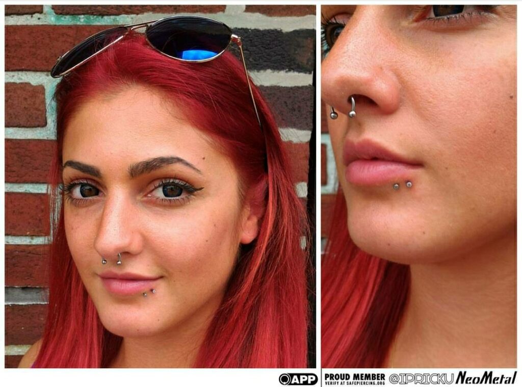 Lip Piercing in Staten Island, NYC | Professional Piercing Paired lip piercings featuring titanium bezel-set gemstone ends from NeoMetal, captured post-downsizing to showcase improved fit and healing progress.