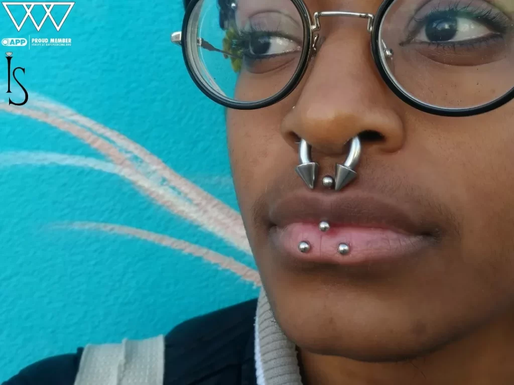 Side profile highlighting the alignment and depth of two inverse vertical labret piercings with implant-grade titanium jewelry, emphasizing the bold and expressive aesthetic.