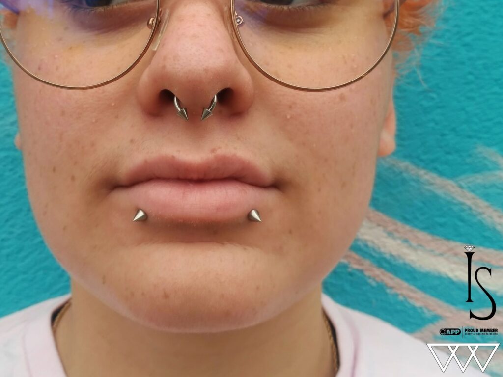Lip Piercing in Staten Island, NYC | Professional Piercing Close-up of paired lip piercings featuring titanium spike ends from NeoMetal, highlighting the symmetrical placement and the sleek, edgy design of the jewelry.