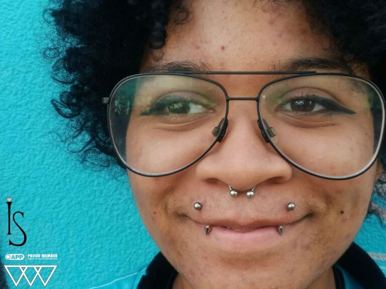 Upper Vertical Lips